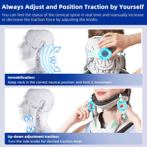 Twinklepoch Cervical Neck Traction Device, Cervical Traction Device for Neck Pain Relief, Adjustable 3 Power Tractions Neck Stretcher Cervical Traction, Manual Air Pump, Home Use (Blue)